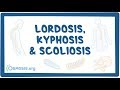 Lordosis, kyphosis, and scoliosis