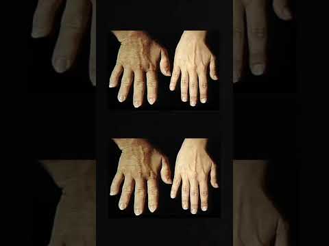 هناك بعض الناس قصار القامة ما هي القزامة