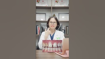 răng thưa nên bọc sứ #shorts #xuhuong #bocrangsu