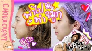 Vlog พาไปทำจมูก บอกหมดเปลือกบอกทุกเม็ด!!! | Chouxcream