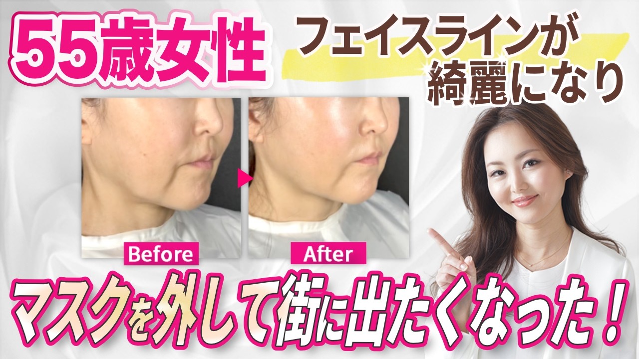 【衝撃】55歳のフェイスライン、3ヶ月でここまで若返る