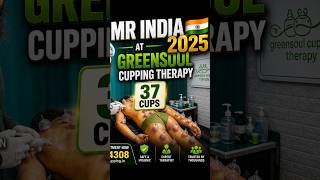 37 Cups Full Body Hijama! 🤯 Mr India 2025 Mikail Ameer | Greensoul Cupping Therapy Ranchi Jharkhand