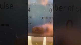 Reck Viva2 vid