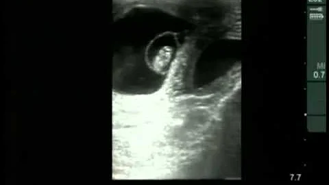 Cow #4539 Day 37 of Gestation