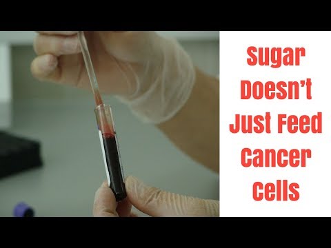 sugar-doesn’t-just-feed-cancer-cells,-it-produces-them