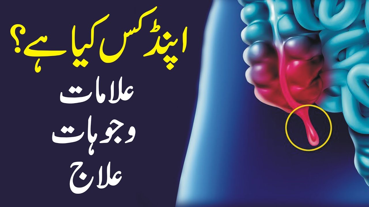 What is appendix causes symptoms treatment health tips utv