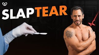 How To Avoid Slap Tear Surgery [WATCH THIS]