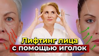 СЕКРЕТ МОЛОДОСТИ. Акупунктурный лифтинг — польза или вред?