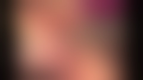 Safe Dissection of Calot