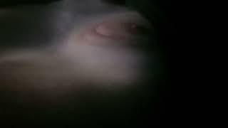 Very Hard Pounding & Visible Skipping Heartbeat After 15X Long & Strong Vt In A Row. Part 12