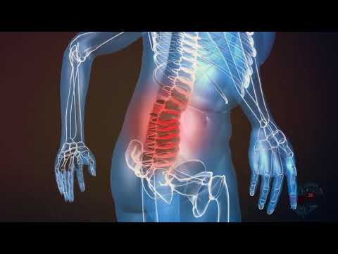 cáncer de próstata con metástasis óseas curables