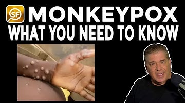 Monkeypox 101: Everything You Need To Know About Outbreak