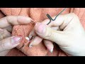 How to Seamlessly Mend a Hole in Your Sweater