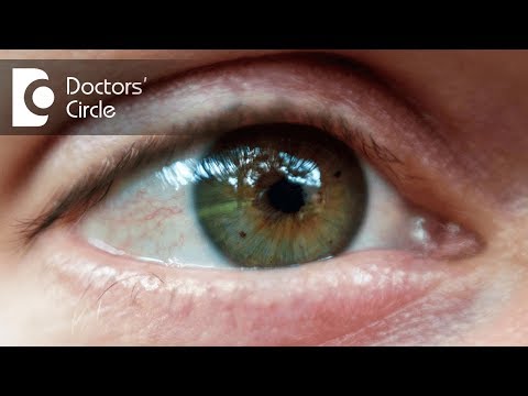 Video: Majú krtkovia oči?