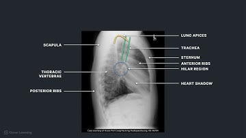 How to Recognize Key Anatomy on Chest Radiographs