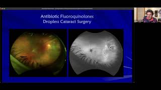 Complications of Pharmaceuticals Every Optometrist Should Know