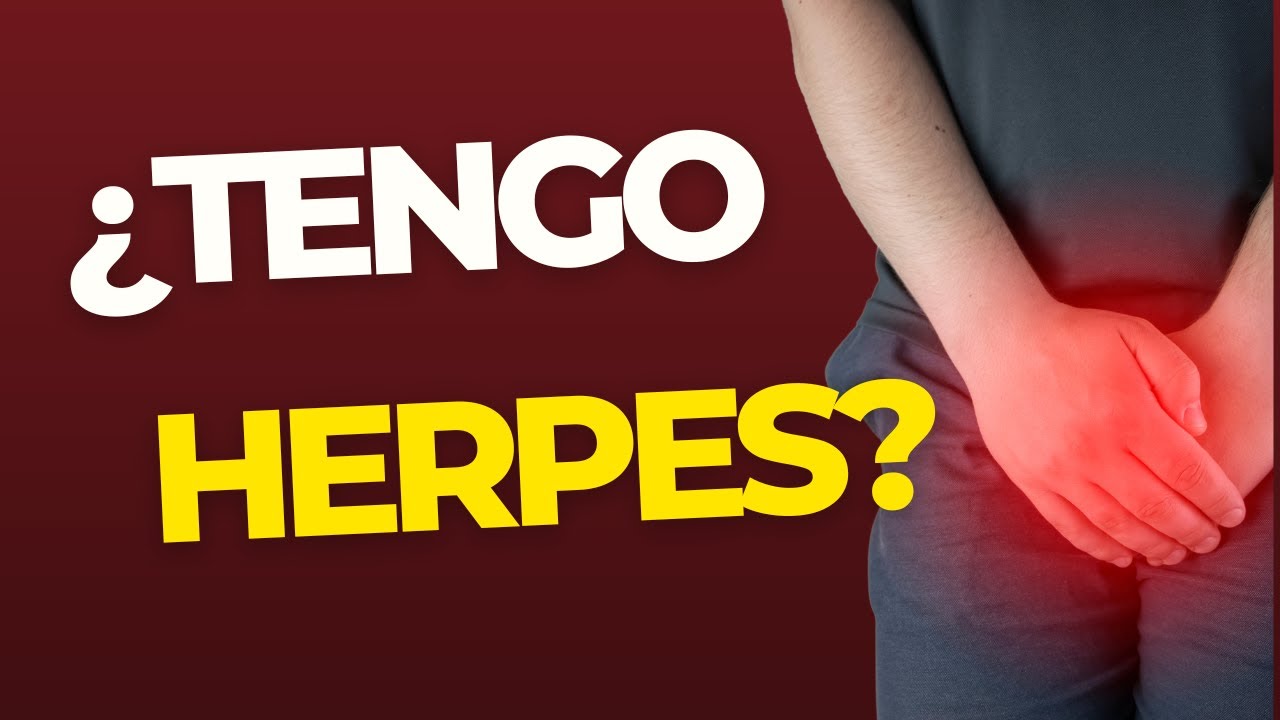 TENGO HERPES GENITAL? Lo que debes saber - YouTube