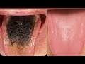 INSTANT CURE FOR BAD BREATH | YOUR MOUTH WILL NEVER SMELL AGAIN