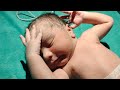 Today I had two new babies, both are fine | The baby who was a little serious yesterday is also fine