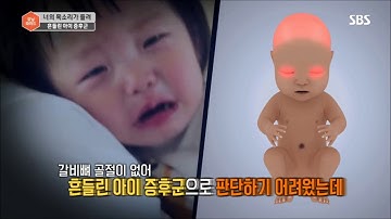 [SBS 모닝와이드 – 아이를 두팔로 안고 흔드는 행위는 학대행위?]