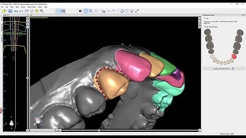 BlueSkyBio - Digital Orthodontics