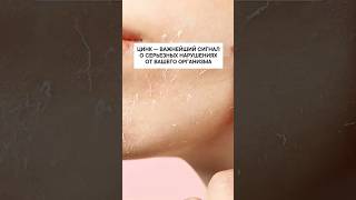 Цинк – важнейшие сигналы серьезных нарушениях от вашего организма￼