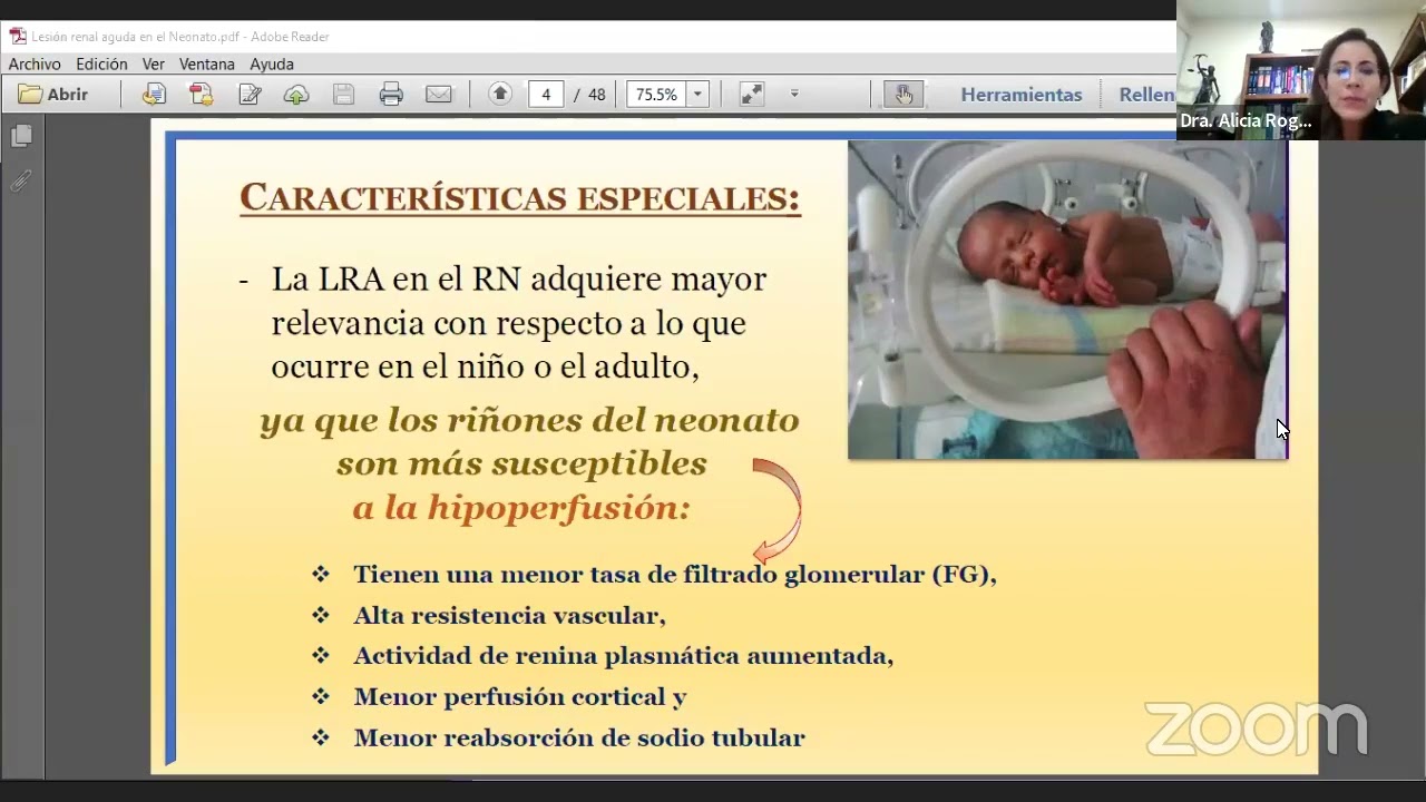 Lesión Renal Aguda en el Neonato