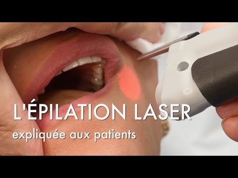 L'épilation laser expliquée au patients - Centre Marceau Paris