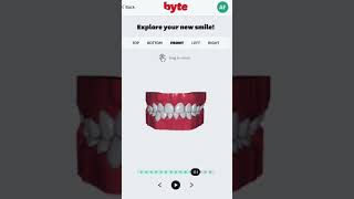 Celebrity Byte 3D treatment (aligners) Profile