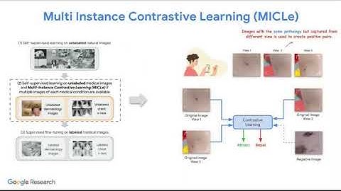 Self-Supervised Learning Advances Medical Image Classification