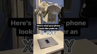 Celebrity Did it exceed your expectations? ☢️ X-Ray technology never gets old to us! #shorts #RadNet #XRay Wealth