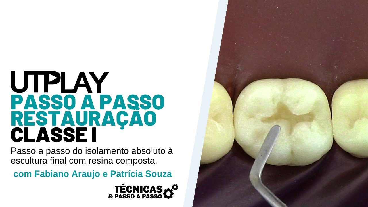 CLASSE I -Passo a Passo da Restauração Classe I - Dr. Fabiano Araujo e Dra. Patrícia Souza -UTPLAY