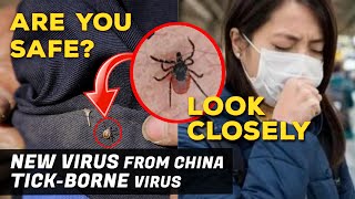 China's New Tick-borne virus - Symptoms & Precautions (Lyme disease) by Fury of Awesomeness 12,415 views 3 years ago 1 minute, 30 seconds