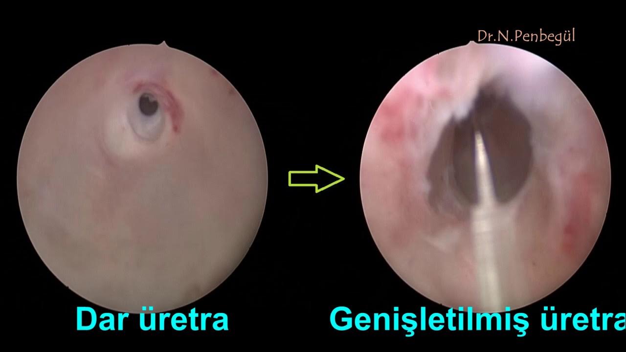 Tasmali porno onlayn Yalangoch keksa ayollarning yalangoch fotosuratlari