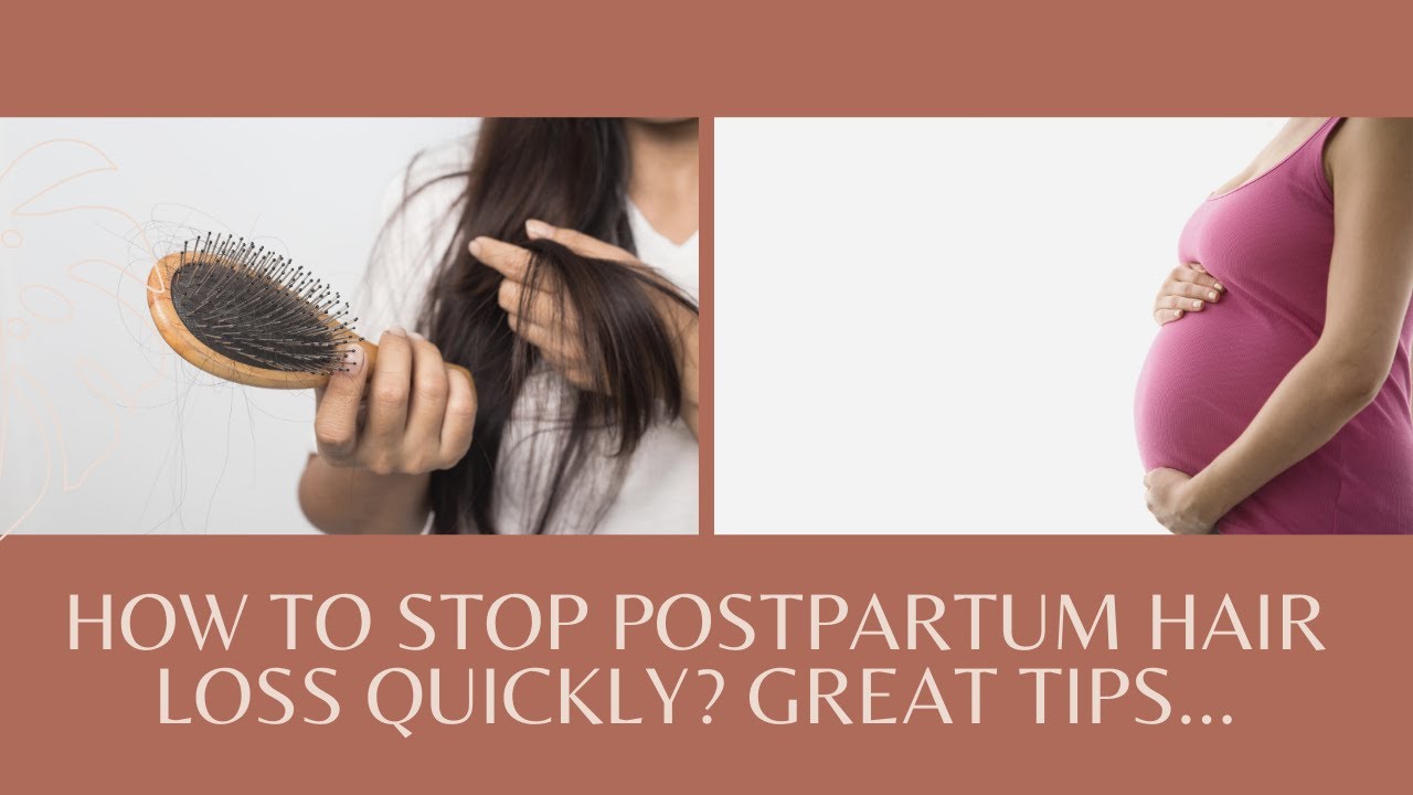 How To Stop Postpartum Hair Loss Quickly Great Tips YouTube