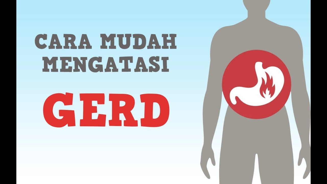 Cara Mengatasi gerd|asam lambung naik ke kerongkongan