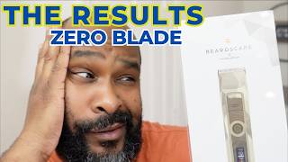 Brio Beardscape v2 Trimmer Limited Edition Frost Bundle Review: Zero Blade, Zero Problems?