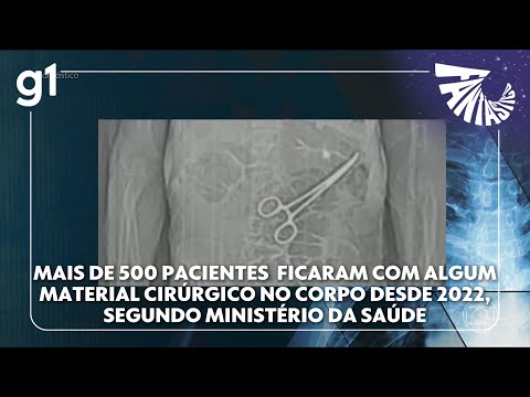 Fantástico: Estudo revela alto índice de pacientes que ficaram com algum material cirúrgico no corpo