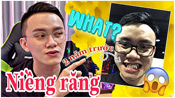 ✅ 2 năm ❌Niềng răng❌ ĐƯỢC - MẤT những gì ❓❓❓| Nhật ký niềng răng của mình | Cọp Ú VLOG