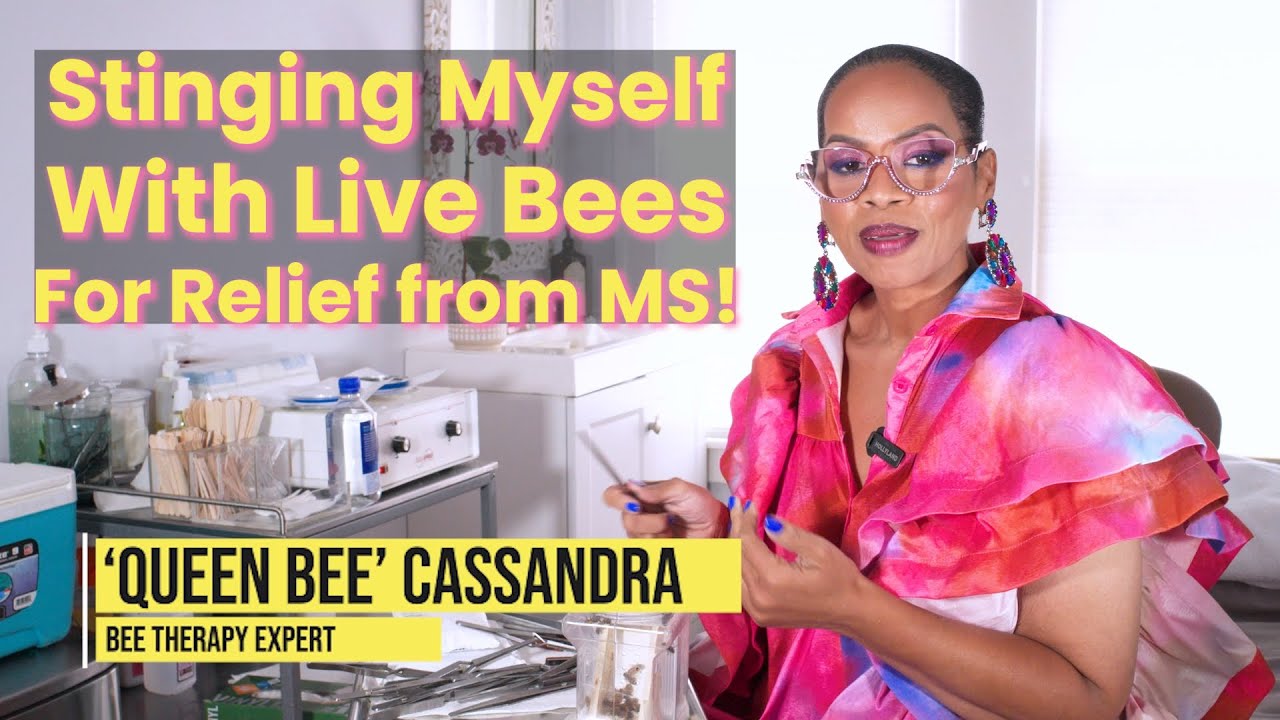 Stinging My Nerve Points with LIVE Bees for Relief: A Personal Experiment