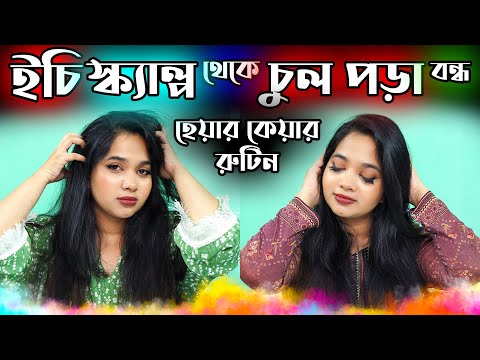 ভিডিও: Dmdm hydantoin চুল পড়ার কারণ হতে পারে?