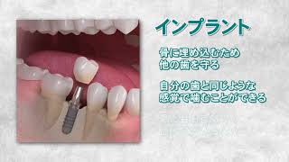 希少　アナトミーからのインプラント外科手順 希少 アナトミーからのインプラント外科手順 希少 アナトミー