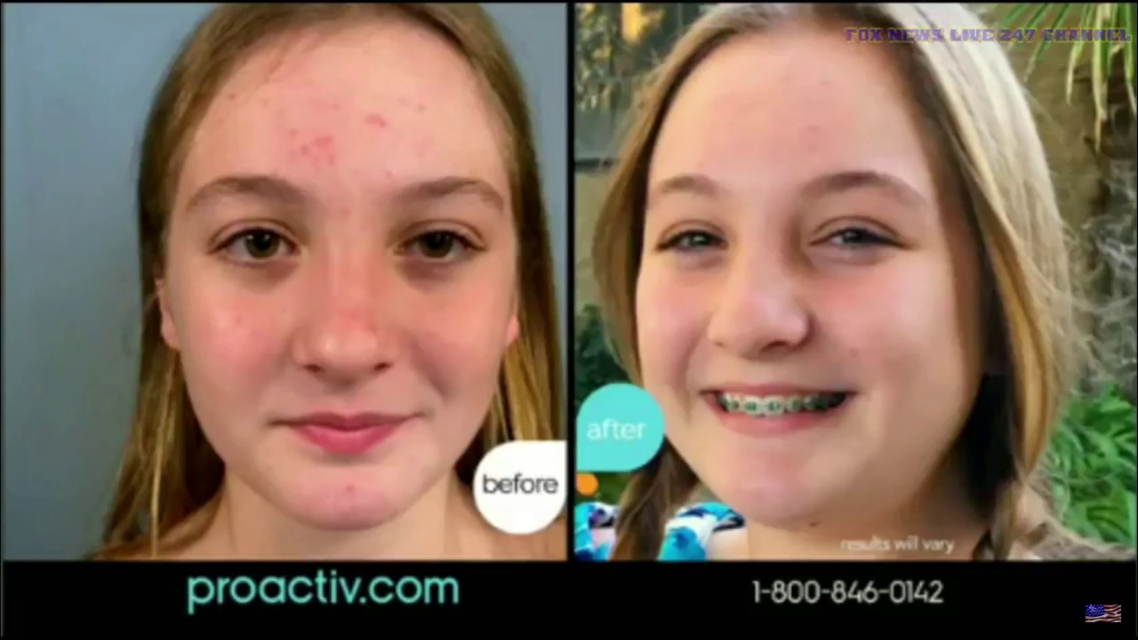 Fox News Live 24/7 HD Fox News Live Stream Today Fox News Live Now