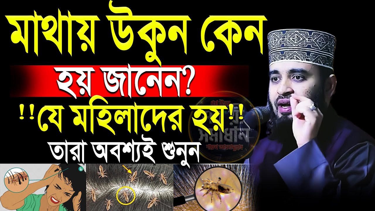 যে মহিলাদের মাথায় উকুন হয় তারা গোপন তথ্যগুলো জানুন💓mizanur rahman azhari-ep=16 Jan 17 2026 