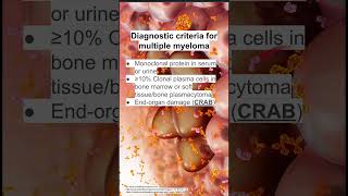 Diagnostic criteria for multiple myeloma screenshot 2