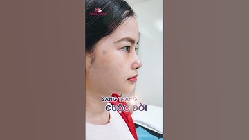 Siêu phẩm dáng mũi sụn SurgiForm - Mở lối nhan sắc - Sang trang cuộc đời
