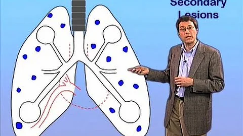 TB Dissemination - John McKinney (EPFL)