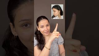 My acne journey: part-1 #acnetips #acne #acneproneskin #acnecauses