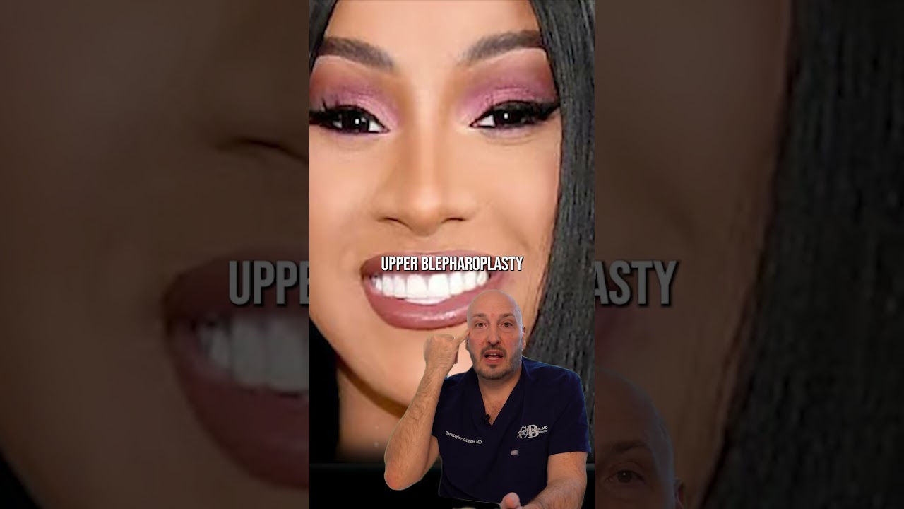 The FAMOUS Cardi B: Before & After Plastic Surgery – Let’s Talk! | Dr. Balinger