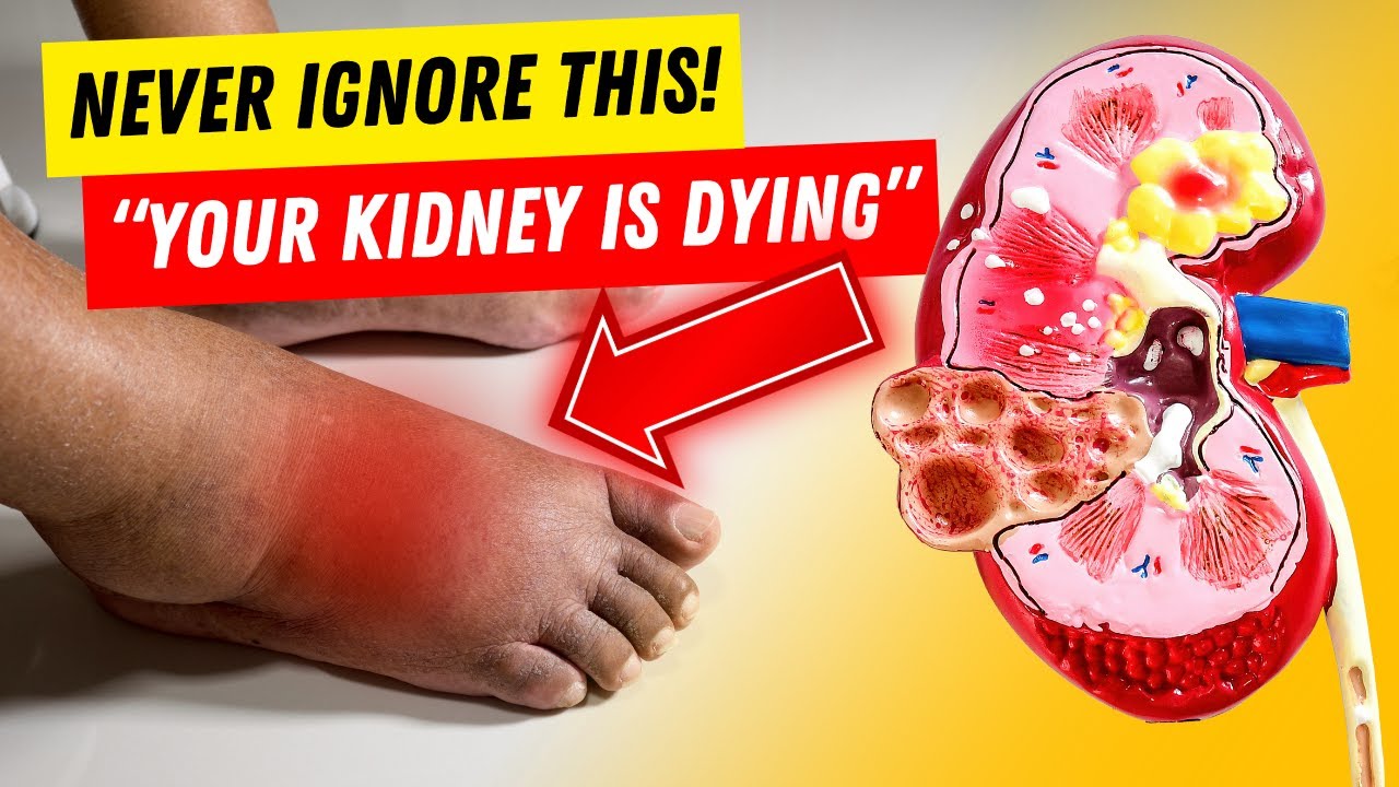 10 Kidney Failure Symptoms | First Signs of Kidney Failure
